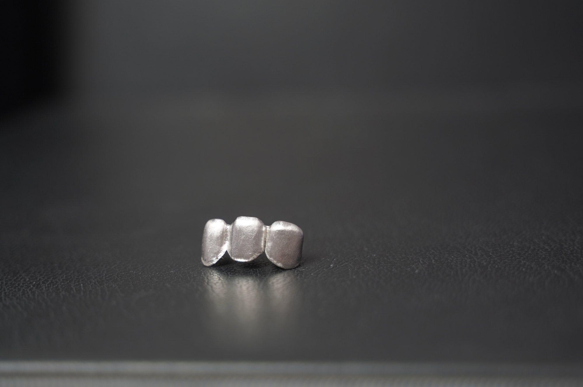 Metal bridge photographed from the occlusal side